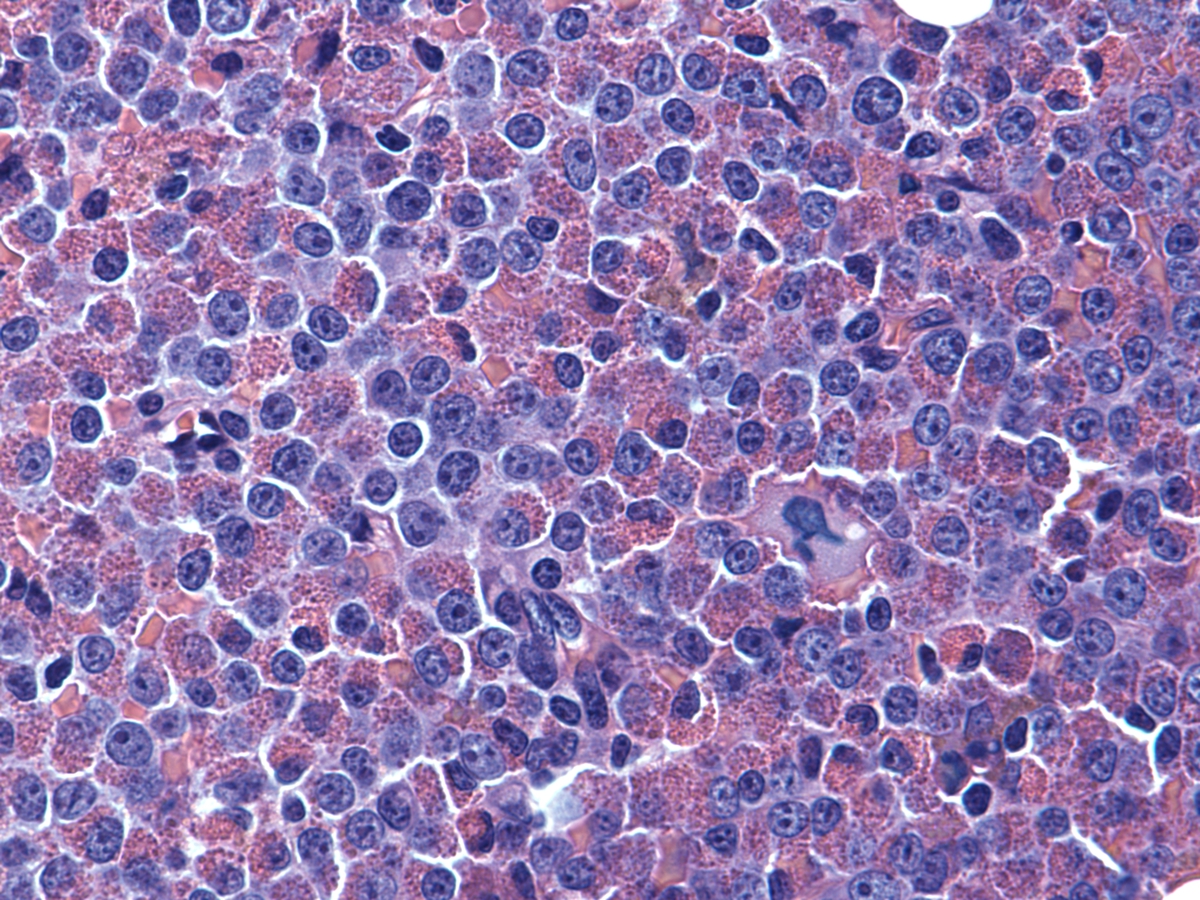 Bone marrow clot section